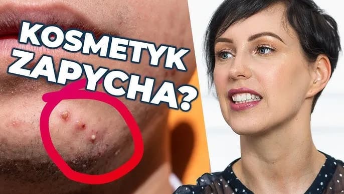 Jak wygląda zapchana cera? Objawy, które musisz znać, by działać