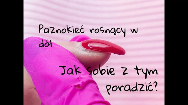 Jak wyprostować paznokcie rosnące w dół i uniknąć problemów zdrowotnych